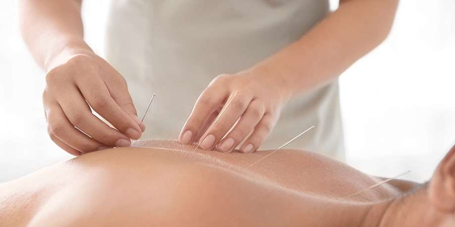 Benefits of Acupuncture for People with Diabetes
