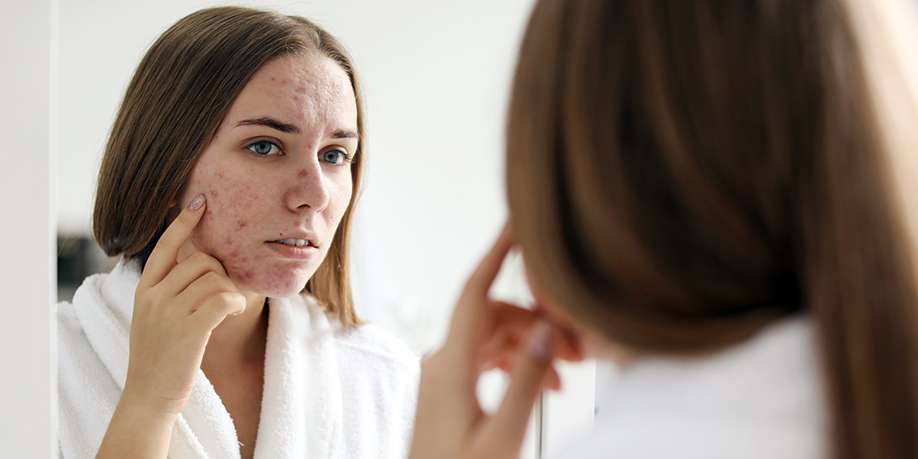 Connection Between Acne and Diabetes