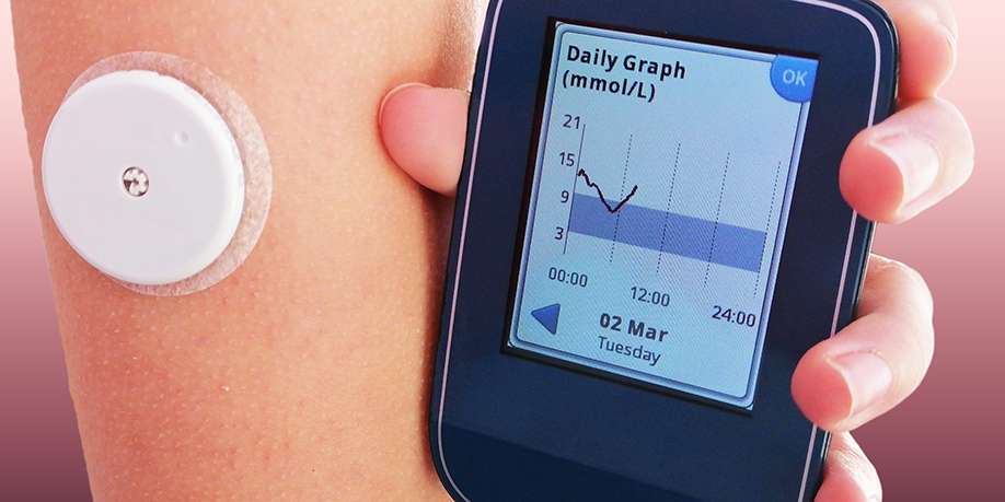 Dexcom G6 - Everything You Need to Know!